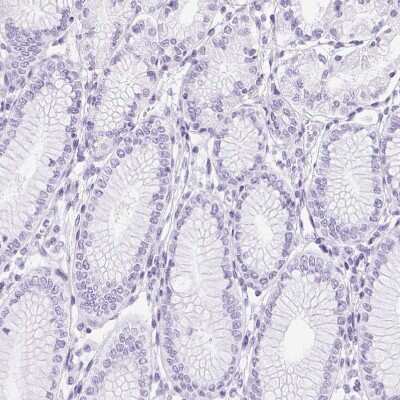 Immunohistochemistry-Paraffin: SP9 Antibody [NBP2-38967] - Staining of human stomach shows no positivity in glandular cells as expected.