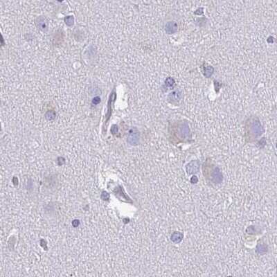Immunohistochemistry-Paraffin: SPACA1 Antibody [NBP2-38506] - Staining of human cerebral cortex.