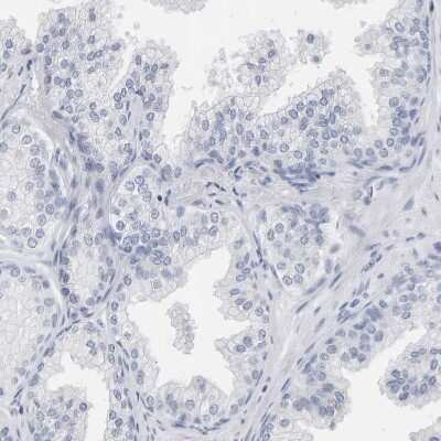 Immunohistochemistry: SPACA3 Antibody [NBP1-89136] - Staining of human prostate shows no positivity in glandular cell as expected.