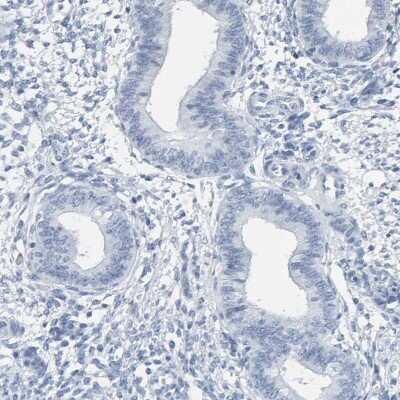 Immunohistochemistry-Paraffin: SPACA3 Antibody [NBP1-89136] - Staining of human endometrium shows no positivity in glandular cells as expected.