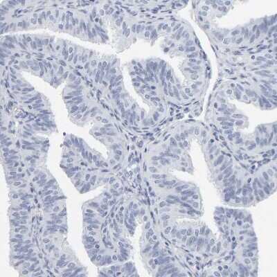 Immunohistochemistry-Paraffin: SPACA3 Antibody [NBP1-89136] - Staining of human fallopian tube shows no positivity in glandular cells as expected.
