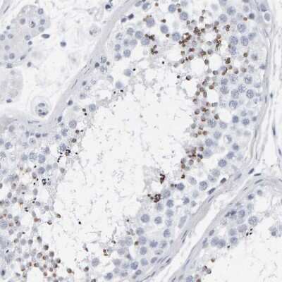 Immunohistochemistry-Paraffin: SPACA3 Antibody [NBP1-89136] - Staining of human testis shows strong cytoplasmic positivity in spermatids.