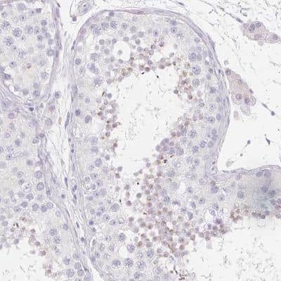 Immunohistochemistry: SPACA5 Antibody [NBP2-46703] - Staining of human testis shows cytoplasmic positivity in acrosomal cap of sperm.