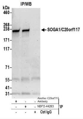Immunoprecipitation: SPACA9 Antibody [NBP2-44283] - Western Blot of Immunoprecipitates. Samples: Whole cell lysate (0.5 or 1.0 mg per IP reaction; 20% of IP loaded) from HeLa cells prepared using NETN lysis buffer. NBP2-44283 was used for IP at 6 ug per reaction. SOGA1/C20orf117 was also immunoprecipitated by another rabbit anti-SOGA1/C20orf117 antibody.