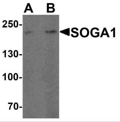 Western Blot: SPACA9 Antibody [NBP2-82011] - Analysis of SPACA9 in HeLa cell lysate with SPACA9 antibody at (A) 1 and (B) 2 ug/ml.