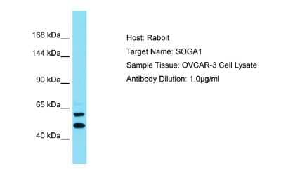 Western Blot: SPACA9 Antibody [NBP2-85793] - Host: Rabbit. Target Name: SOGA1. Sample Type: OVCAR-3 Whole Cell lysates. Antibody Dilution: 1.0ug/mlSOGA1 is supported by BioGPS gene expression data to be expressed in OVCAR3