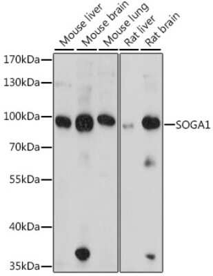 Western Blot: SPACA9 Antibody [NBP2-94689] - Analysis of extracts of various cell lines, using SPACA9 at 1:1000 dilution. Secondary antibody: HRP Goat Anti-Rabbit IgG (H+L) at 1:10000 dilution. Lysates/proteins: 25ug per lane. Blocking buffer: 3% nonfat dry milk in TBST. Detection: ECL Basic Kit . Exposure time: 15s.