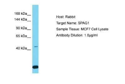 Western Blot: SPAG1 Antibody [NBP2-88340] - Host: Rabbit. Target Name: SPAG1. Sample Tissue: Human MCF7 Whole Cell. Antibody Dilution: 1ug/ml