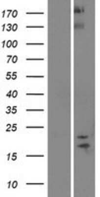 Western Blot: SPAG11B Overexpression Lysate (Adult Normal) [NBP2-05795] Left-Empty vector transfected control cell lysate (HEK293 cell lysate); Right -Over-expression Lysate for SPAG11B.