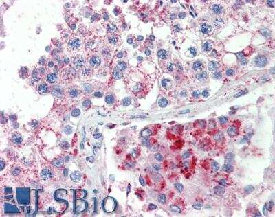 Immunohistochemistry-Paraffin SPAG16 Antibody