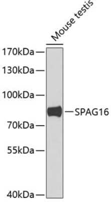 Western Blot: SPAG16 Antibody [NBP2-93205] - Analysis of extracts of mouse testis, using SPAG16 at 1:1000 dilution.Secondary antibody: HRP Goat Anti-Rabbit IgG (H+L) at 1:10000 dilution.Lysates/proteins: 25ug per lane.Blocking buffer: 3% nonfat dry milk in TBST.Detection: ECL Basic Kit .Exposure time: 90s.