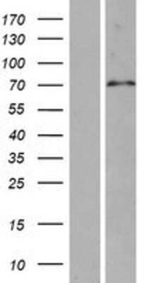 Western Blot: SPAG16 Overexpression Lysate (Adult Normal) [NBP2-06322] Left-Empty vector transfected control cell lysate (HEK293 cell lysate); Right -Over-expression Lysate for SPAG16.