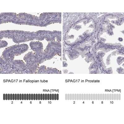 Immunohistochemistry-Paraffin: SPAG17 Antibody [NBP1-93841] - Staining in human fallopian tube and prostate tissues using anti-SPAG17 antibody. Corresponding SPAG17 RNA-seq data are presented for the same tissues.