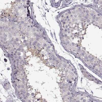 Immunohistochemistry-Paraffin: SPAG17 Antibody [NBP1-93841] - Staining of human testis shows moderate cytoplasmic positivity in spermatids in seminiferous ducts.