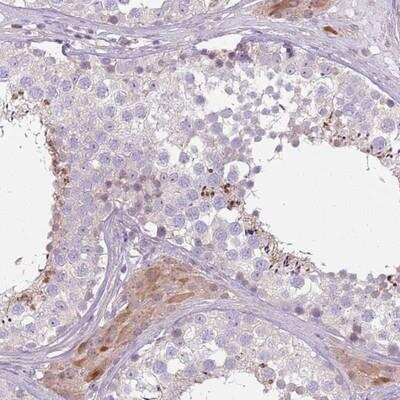 Immunohistochemistry-Paraffin: SPAG4 Antibody [NBP2-13367] - Staining of human testis shows distinct cytoplasmic positivity in spermatids(acrosomal cap).