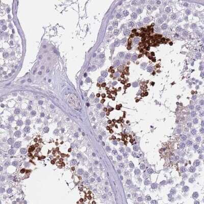 Immunohistochemistry-Paraffin SPAG4L Antibody