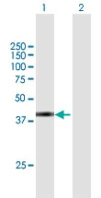 Western Blot: SPAG4L Antibody [H00140732-B02P] - Analysis of SPAG4L expression in transfected 293T cell line by SPAG4L polyclonal antibody.  Lane 1: SPAG4L transfected lysate(41.69 KDa). Lane 2: Non-transfected lysate.