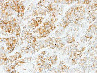 Immunohistochemistry-Paraffin: SPAG6 Antibody [NBP2-20463] - MCF7 xenograft, using SPAG6  antibody at 1:500 dilution. Antigen Retrieval: Citrate buffer, pH 6.0, 15 min.