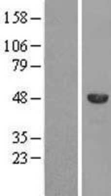 Western Blot: SPAG8 Overexpression Lysate (Adult Normal) [NBL1-16368] Left-Empty vector transfected control cell lysate (HEK293 cell lysate); Right -Over-expression Lysate for SPAG8.