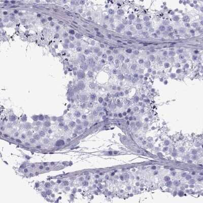 Immunohistochemistry SPANX-D Antibody