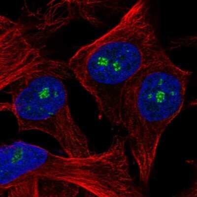 Immunocytochemistry/Immunofluorescence: SPANXN3 Antibody [NBP2-58279] - Staining of human cell line SK-MEL-30 shows localization to nucleoli fibrillar center.