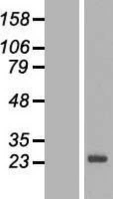 Western Blot SPANXN3 Overexpression Lysate