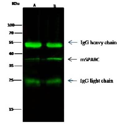 Immunoprecipitation: SPARC Antibody (001) [NBP2-90612] - Mouse SPARC was immunoprecipitated using: Lane A: 0.5 mg A549 Whole Cell Lysate. Lane B: 0.5 mg 293T Whole Cell Lysate. 0.5 ul anti-Mouse SPARC rabbit monoclonal antibody and 15 ul of 50 % Protein G agarose. Primary antibody: Anti-Mouse SPARC rabbit monoclonal antibody, at 1:500 dilution. Secondary antibody: Dylight 800-labeled antibody to rabbit IgG (H+L), at 1:5000 dilution. Developed using the Odyssey technique. Performed under reducing conditions. Predicted band size: 35 kDa. Observed band size: 38 kDa