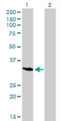 Western Blot: SPARC Antibody (1B2) [H00006678-M02] - Analysis of SPARC expression in transfected 293T cell line by SPARC monoclonal antibody (M02), clone 1B2.Lane 1: SPARC transfected lysate(34.6 KDa).Lane 2: Non-transfected lysate.