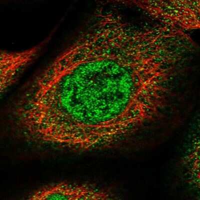 Immunocytochemistry/Immunofluorescence: SPATA13 Antibody [NBP1-90848] - Staining of human cell line A-431 shows localization to nucleoplasm & cytosol. Antibody staining is shown in green.