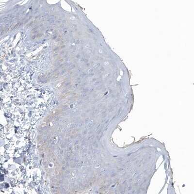 Immunohistochemistry-Paraffin: SPATA18 Antibody [NBP1-81984] - Staining of human skin shows no positivity in squamous epithelial cells as expected.