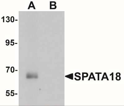 Western Blot: SPATA18 Antibody [NBP2-41148] - Western blot analysis of SPATA18 in rat lung tissue lysate with SPATA18 antibody at 1 ug/mL in (A) the absence and (B) the presence of blocking peptide