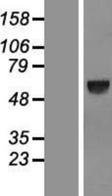 Western Blot: SPATA18 Overexpression Lysate (Adult Normal) [NBL1-16377] Left-Empty vector transfected control cell lysate (HEK293 cell lysate); Right -Over-expression Lysate for SPATA18.