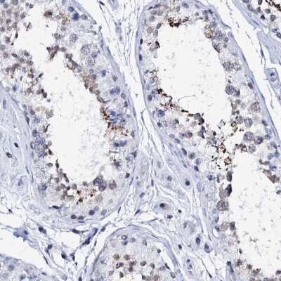 Immunohistochemistry-Paraffin SPATA19 Antibody