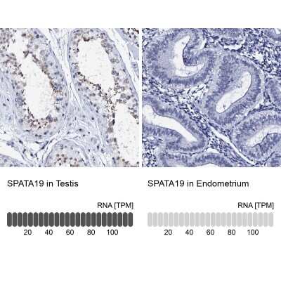 Immunohistochemistry-Paraffin SPATA19 Antibody