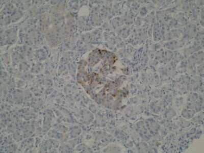 Immunohistochemistry: SPATA2 Antibody (Z1P1F10/F12) [NBP2-50304] - Staining of human pancreas sections. Cytoplasmic staining is observed in Islets of Langerhans.