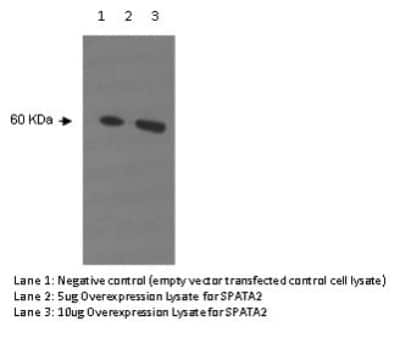 Western Blot: SPATA2 Antibody (Z1P1F10/F12) [NBP2-50304]