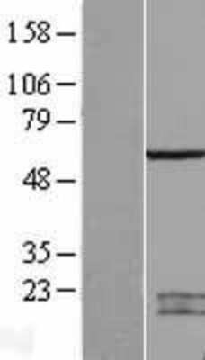 Western Blot: SPATA2 Overexpression Lysate (Adult Normal) [NBL1-16378] Left-Empty vector transfected control cell lysate (HEK293 cell lysate); Right -Over-expression Lysate for SPATA2.