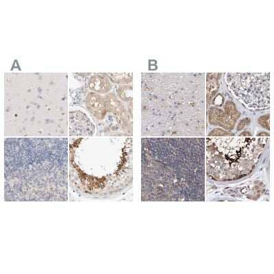 Immunohistochemistry-Paraffin: SPATA20 Antibody [NBP1-82146] - Staining of human cerebral cortex, kidney, lymph node and testis using Anti-SPATA20 antibody NBP1-82146 (A) shows similar protein distribution across tissues to independent antibody NBP1-82148 (B).