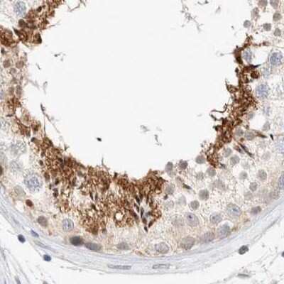 Immunohistochemistry-Paraffin: SPATA20 Antibody [NBP1-82146] - Staining of human testis.