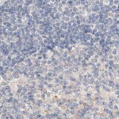 Immunohistochemistry-Paraffin: SPATA20 Antibody [NBP1-82146] - Staining of human lymph node.