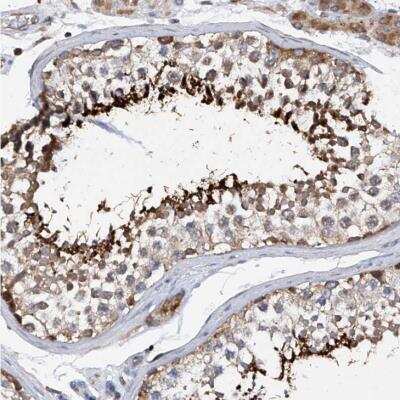 Immunohistochemistry-Paraffin: SPATA20 Antibody [NBP1-82148] - Staining of human testis shows distinct cytoplasmic positivity in subsets of seminiferous duct cells.