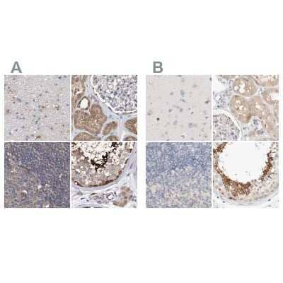 <b>Independent Antibodies Validation. </b>Immunohistochemistry-Paraffin: SPATA20 Antibody [NBP1-82148] - Staining of human cerebral cortex, kidney, lymph node and testis using Anti-SPATA20 antibody NBP1-82148 (A) shows similar protein distribution across tissues to independent antibody NBP1-82146 (B).
