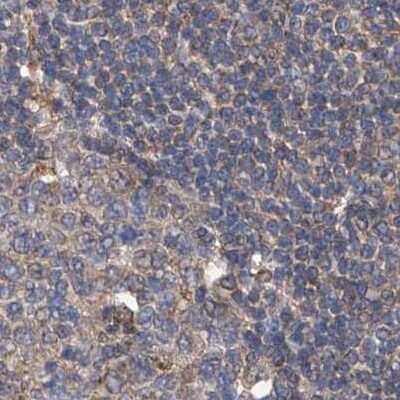 Immunohistochemistry-Paraffin: SPATA20 Antibody [NBP1-82148] - Staining of human lymph node.