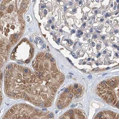 Immunohistochemistry-Paraffin: SPATA20 Antibody [NBP1-82148] - Staining of human kidney.