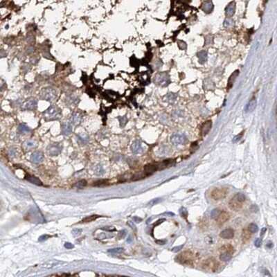 Immunohistochemistry-Paraffin: SPATA20 Antibody [NBP1-82148] - Staining of human testis.