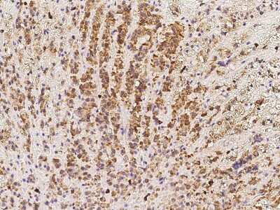 Immunohistochemistry-Paraffin: SPATA20 Antibody [NBP2-97798] - Immunochemical staining of human SPATA20 in human adrenal gland with rabbit polyclonal antibody at 1:100 dilution, formalin-fixed paraffin embedded sections.
