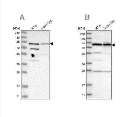 Western Blot: SPATA20 Antibody [NBP1-82146] - Analysis using Anti-SPATA20 antibody NBP1-82146 (A) shows similar pattern to independent antibody NBP1-82147 (B).