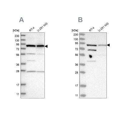 Western Blot: SPATA20 Antibody [NBP1-82147] - Analysis using Anti-SPATA20 antibody NBP1-82147 (A) shows similar pattern to independent antibody NBP1-82146 (B).