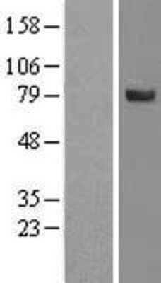 Western Blot: SPATA20 Overexpression Lysate (Adult Normal) [NBL1-16379] Left-Empty vector transfected control cell lysate (HEK293 cell lysate); Right -Over-expression Lysate for SPATA20.