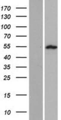 Western Blot: SPATA21 Overexpression Lysate (Adult Normal) [NBP2-04681] Left-Empty vector transfected control cell lysate (HEK293 cell lysate); Right -Over-expression Lysate for SPATA21.